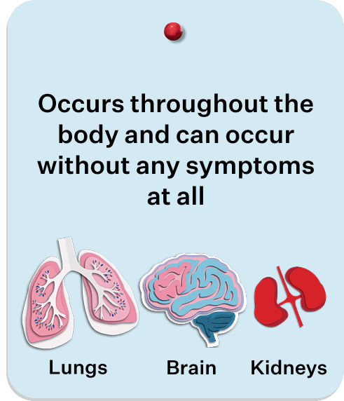 Pinned card showing organ damage can occur throughout the body and without symptoms