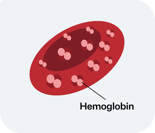 Illustration of a healthy red blood cell with hemoglobin labeled inside