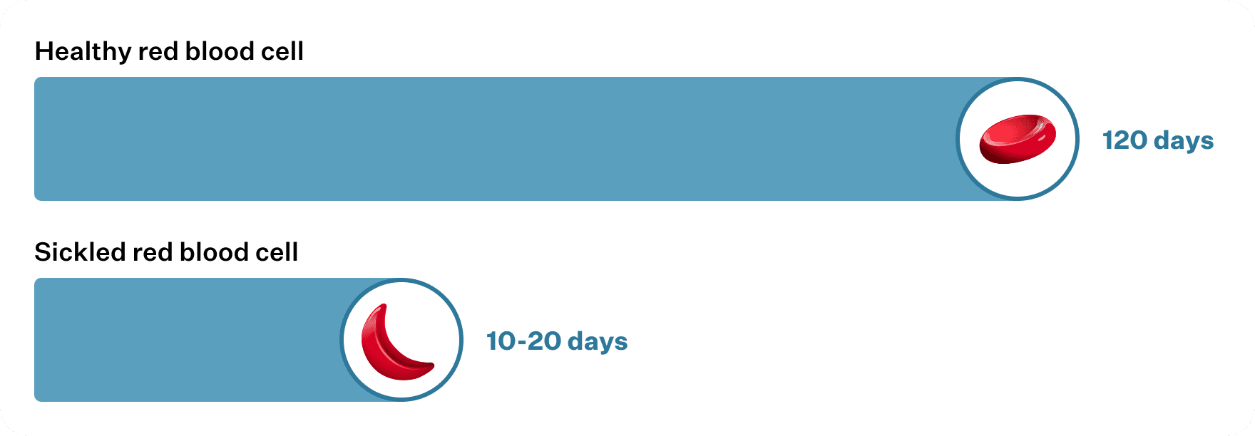 Comparison of healthy and sickled red blood cell lifespans, showing a healthy red blood cell lasting 120 days and a sickled red blood cell lasting 10-20 days