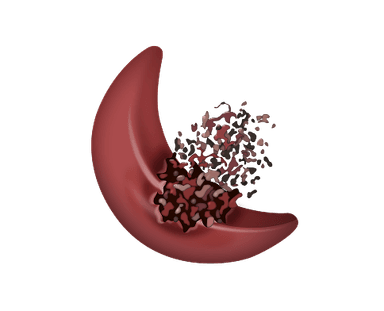 Image of a sickled red blood cell hemolyzing or breaking down