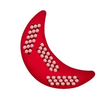 Image of a sickled red blood cell showing hemoglobin rods inside