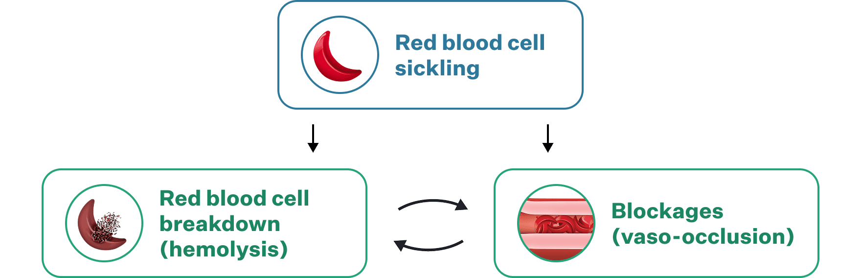 Flow diagram connecting red blood cell sickling, hemolysis, and vaso-occlusion