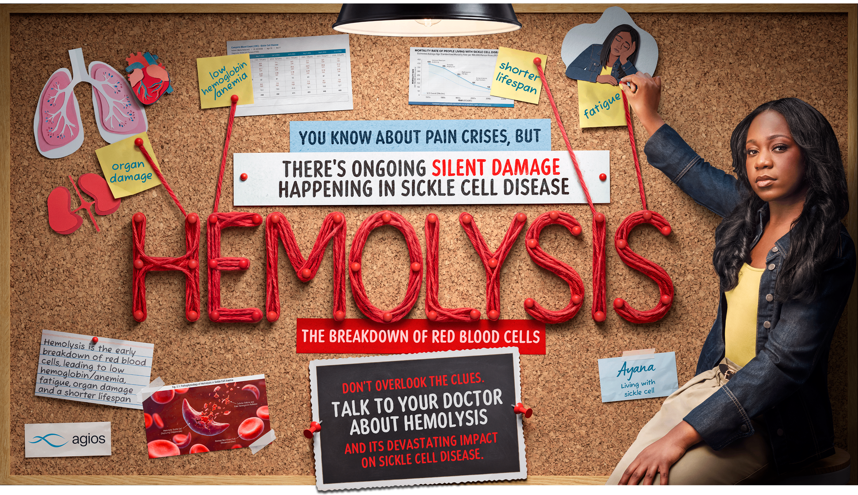 Image of a woman living with sickle cell sitting next to a corkboard that reads: ‘There’s ongoing silent damage happening in sickle cell disease HEMOLYSIS, the breakdown of red blood cells’